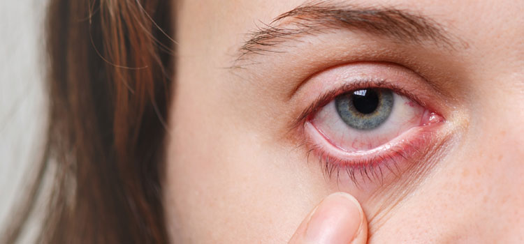 Elmiron Eye Injury Lawyer in San Bruno, CA